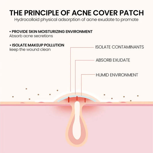 Star Acne Pimple Patches