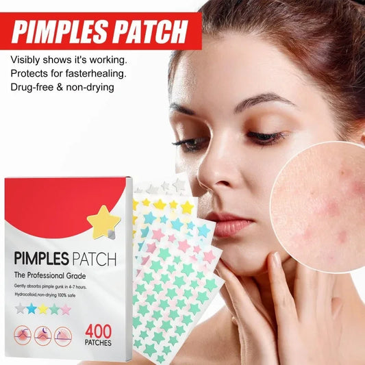 Star Acne Pimple Patches
